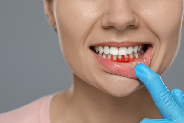 What Is Endodontics? A Guide To Saving Teeth From The Inside Out