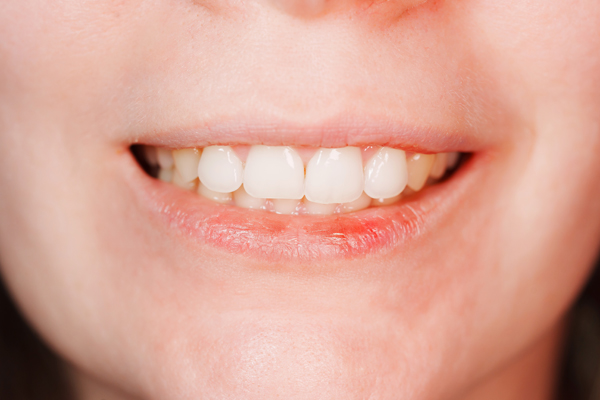 An A To Z Guide To Full Mouth Reconstruction