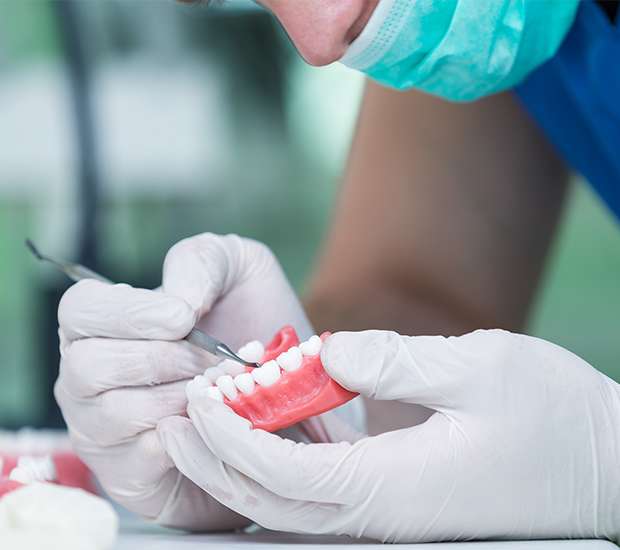 Auburn Hills Partial Denture for One Missing Tooth