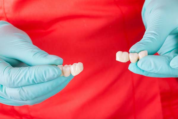 What Are Partial Dentures?