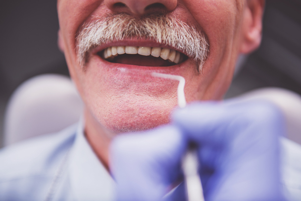 Understanding Routine Dental Procedures