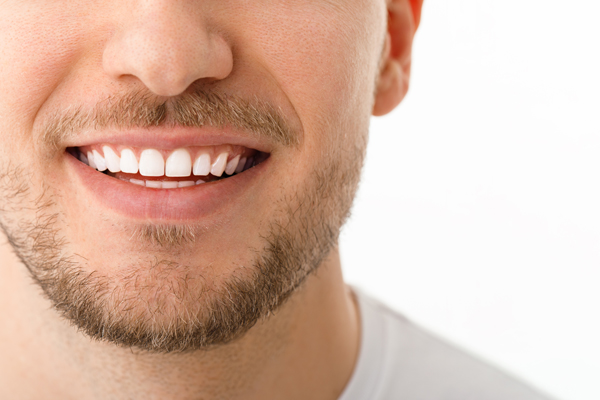 Snap On Smile®: A Non Invasive Alternative To Traditional Restorations